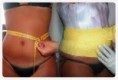/album/galeria-de-fotos%3a-terapias-servi%c3%a7os-crioterapia/imagescayhjdlm-jpg/
