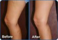/album/galeria-de-fotos%3a-terapias-servi%c3%a7os-crioterapia/imagescarbiqlu-jpg/