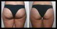 /album/galeria-de-fotos%3a-terapias-servi%c3%a7os-crioterapia/imagesca23jpsy-jpg/