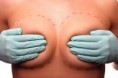 /album/galeria-de-fotos%3a-terapias-servi%c3%a7os-crioterapia/imagesca9wx1wf-jpg/